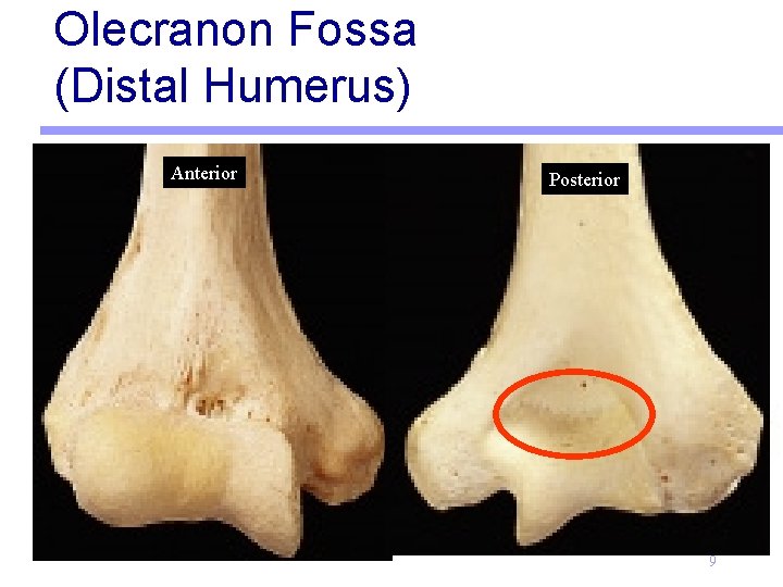 Olecranon Fossa (Distal Humerus) Anterior Posterior 9 
