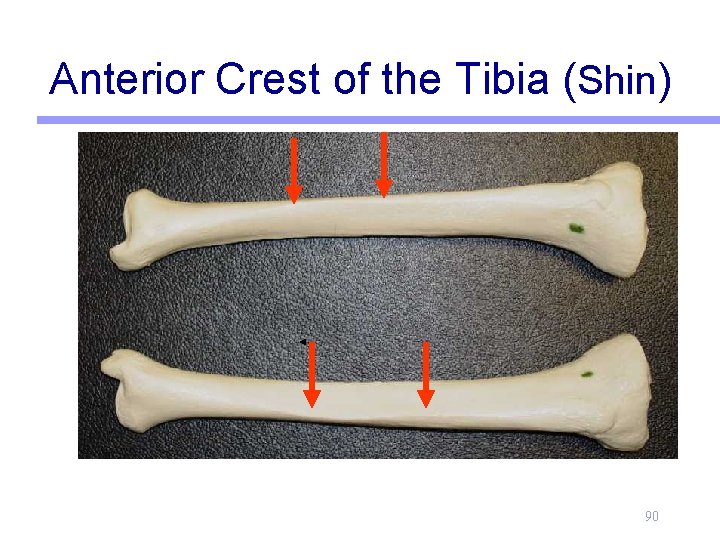 Anterior Crest of the Tibia (Shin) 90 