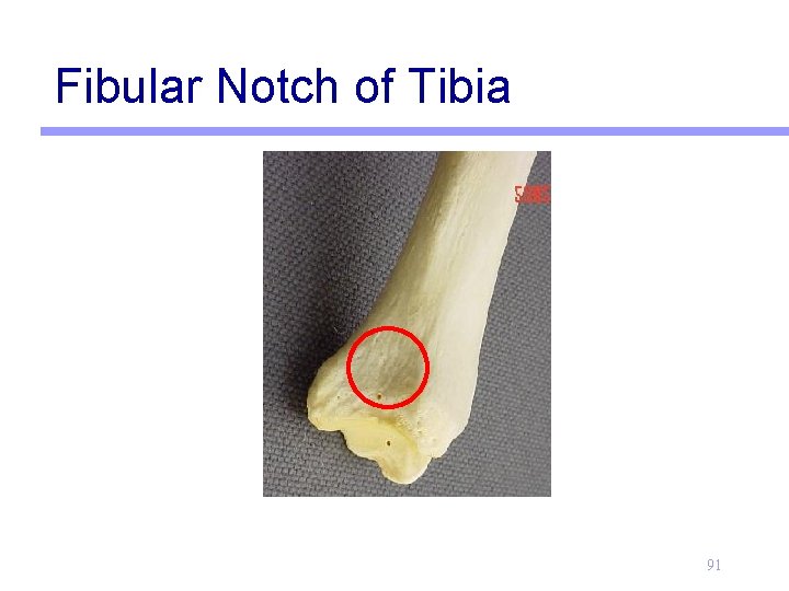 Fibular Notch of Tibia 91 