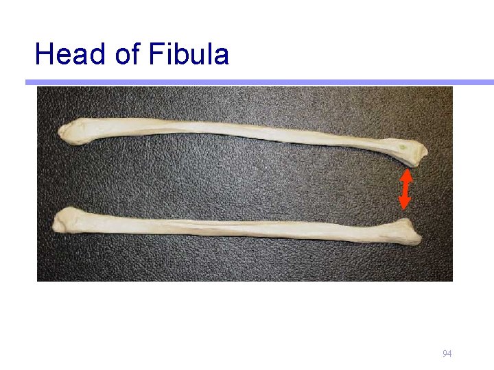 Head of Fibula 94 