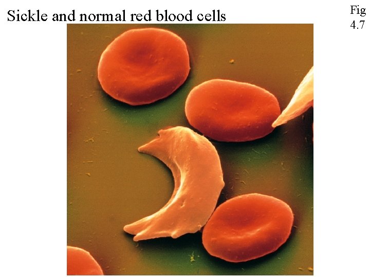 Sickle and normal red blood cells Fig 4. 7 