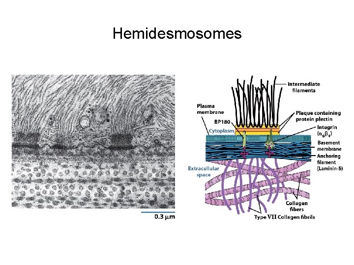 Hemidesmosomes 