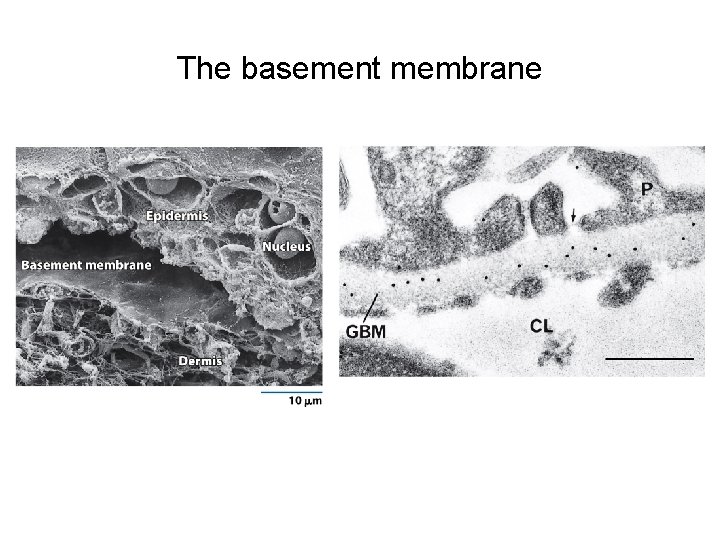 The basement membrane 