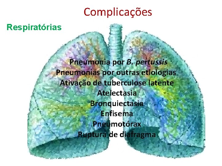 Complicações Respiratórias Pneumonia por B. pertussis Pneumonias por outras etiologias Ativação de tuberculose latente