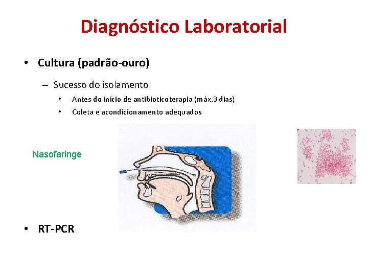 Diagnóstico Laboratorial • Cultura (padrão-ouro) – Sucesso do isolamento • Antes do início de