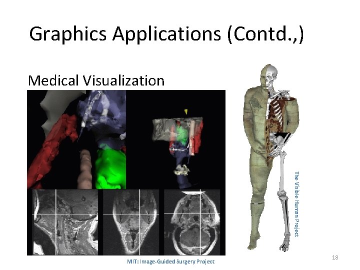 Graphics Applications (Contd. , ) Medical Visualization The Visible Human Project MIT: Image-Guided Surgery Graphics Applications (Contd. , ) Medical Visualization The Visible Human Project MIT: Image-Guided Surgery