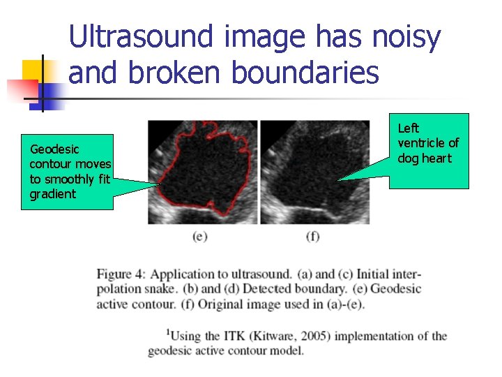 Ultrasound image has noisy and broken boundaries Geodesic contour moves to smoothly fit gradient