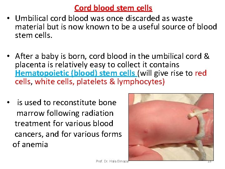 Cord blood stem cells • Umbilical cord blood was once discarded as waste material