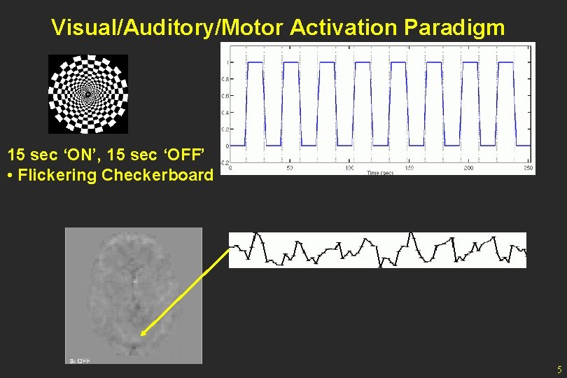 Visual/Auditory/Motor Activation Paradigm 15 sec ‘ON’, 15 sec ‘OFF’ • Flickering Checkerboard 5 