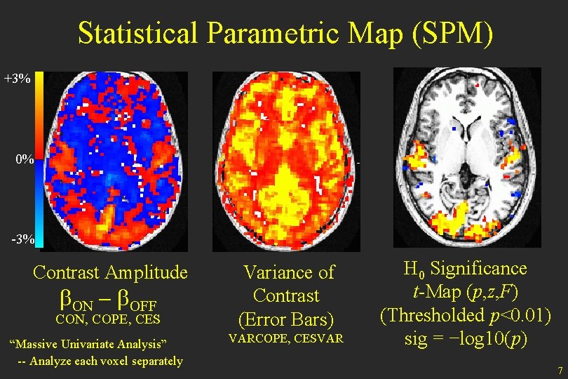 Statistical Parametric Map (SPM) +3% 0% -3% Contrast Amplitude b. ON - b. OFF