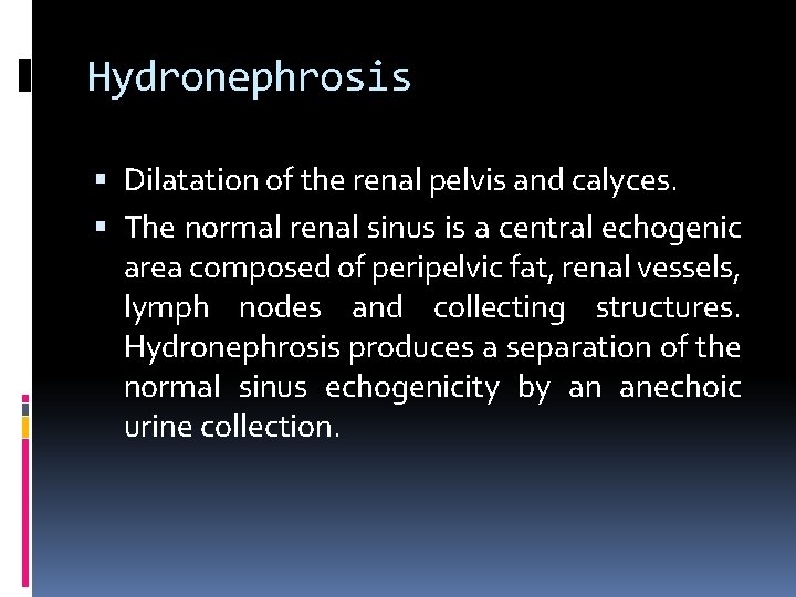 Hydronephrosis Dilatation of the renal pelvis and calyces. The normal renal sinus is a