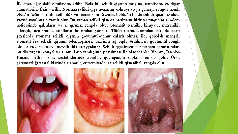 İlk öncə ağız dəhliz müayinə edilir. Belə ki, selikli qişanın rənginə, nəmliyinə və digər