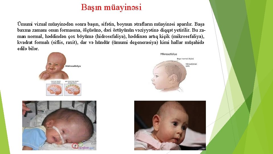 Başın müayinəsi Ümumi vizual müayinədən sonra başın, sifətin, boynun ətrafların müayinəsi aparılır. Başa baxma