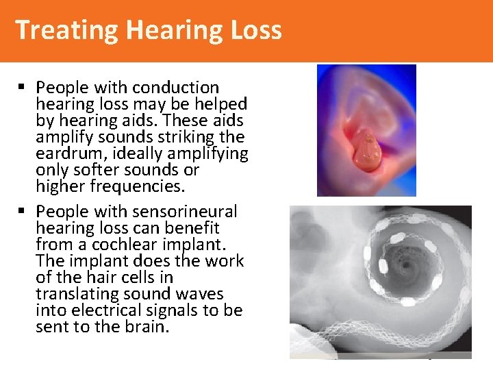 Treating Hearing Loss § People with conduction hearing loss may be helped by hearing
