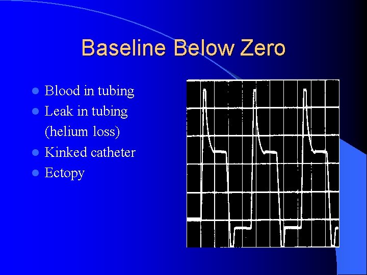 Baseline Below Zero Blood in tubing l Leak in tubing (helium loss) l Kinked