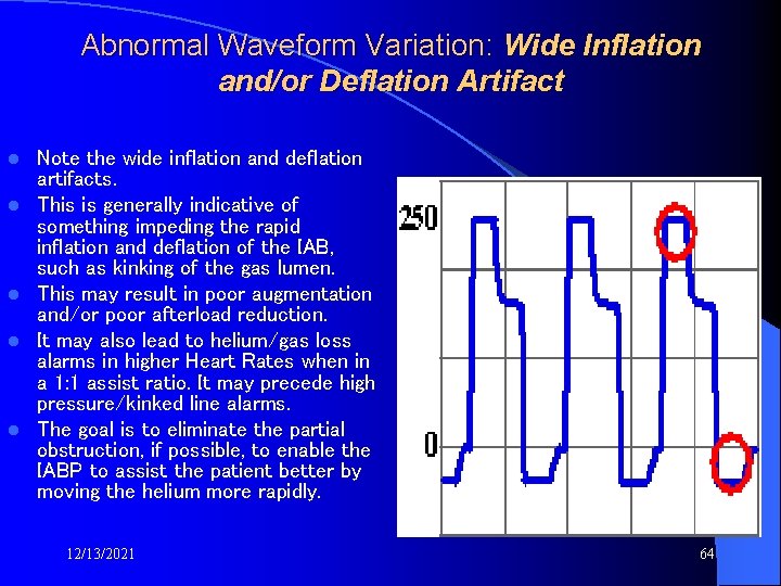 Abnormal Waveform Variation: Wide Inflation and/or Deflation Artifact l l l Note the wide