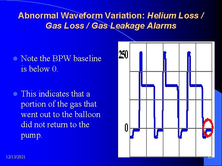 Abnormal Waveform Variation: Helium Loss / Gas Leakage Alarms l Note the BPW baseline