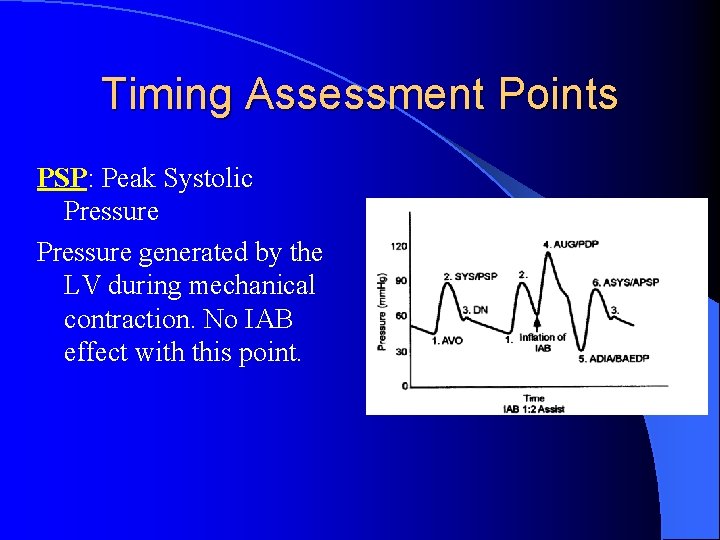 Timing Assessment Points PSP: Peak Systolic Pressure generated by the LV during mechanical contraction.