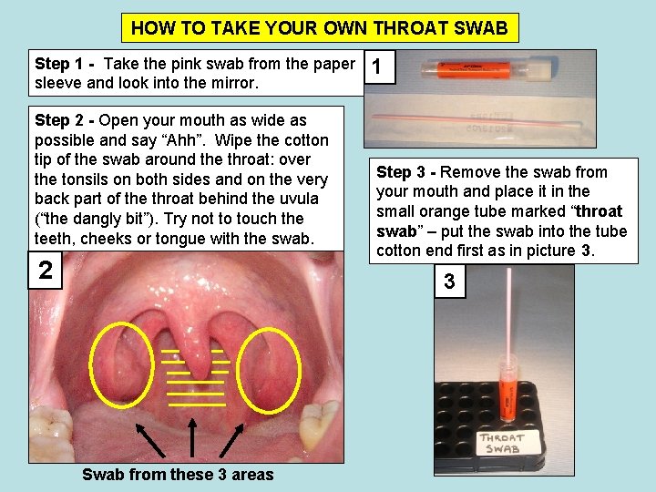 HOW TO TAKE YOUR OWN THROAT SWAB Step 1 - Take the pink swab