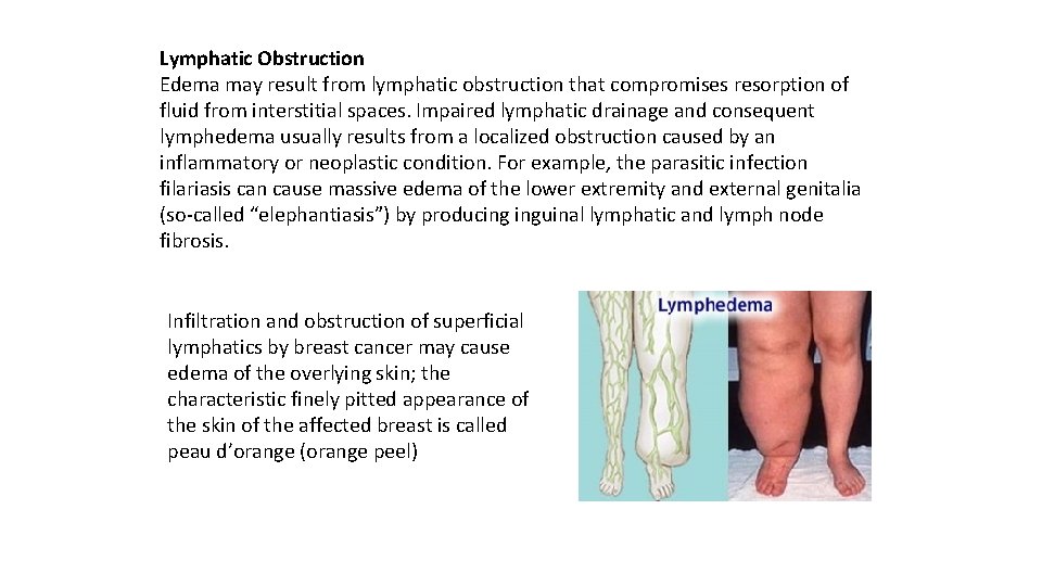 Lymphatic Obstruction Edema may result from lymphatic obstruction that compromises resorption of fluid from
