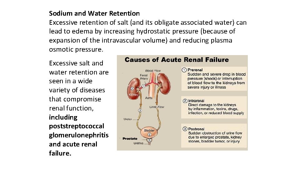 Sodium and Water Retention Excessive retention of salt (and its obligate associated water) can