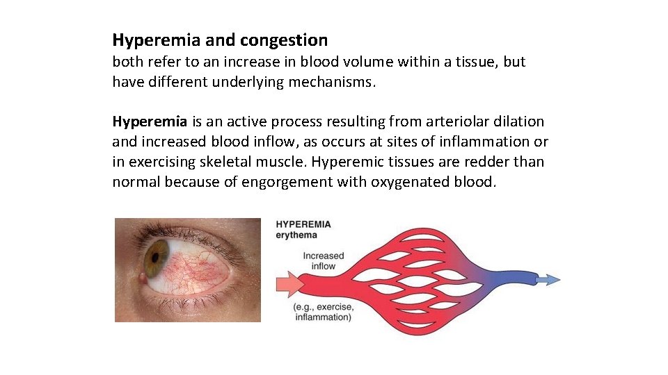 Hyperemia and congestion both refer to an increase in blood volume within a tissue,