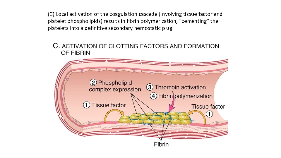 (C) Local activation of the coagulation cascade (involving tissue factor and platelet phospholipids) results