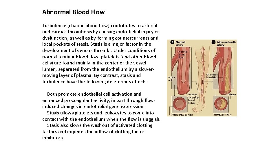 Abnormal Blood Flow Turbulence (chaotic blood flow) contributes to arterial and cardiac thrombosis by
