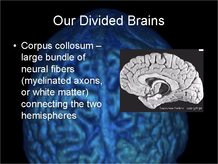 Our Divided Brains • Corpus collosum – large bundle of neural fibers (myelinated axons,