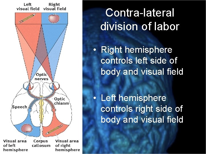 Contra-lateral division of labor • Right hemisphere controls left side of body and visual