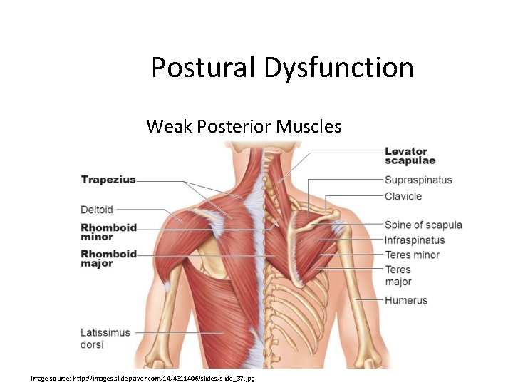 Postural Dysfunction Weak Posterior Muscles Image source: http: //images. slideplayer. com/14/4311406/slides/slide_37. jpg 