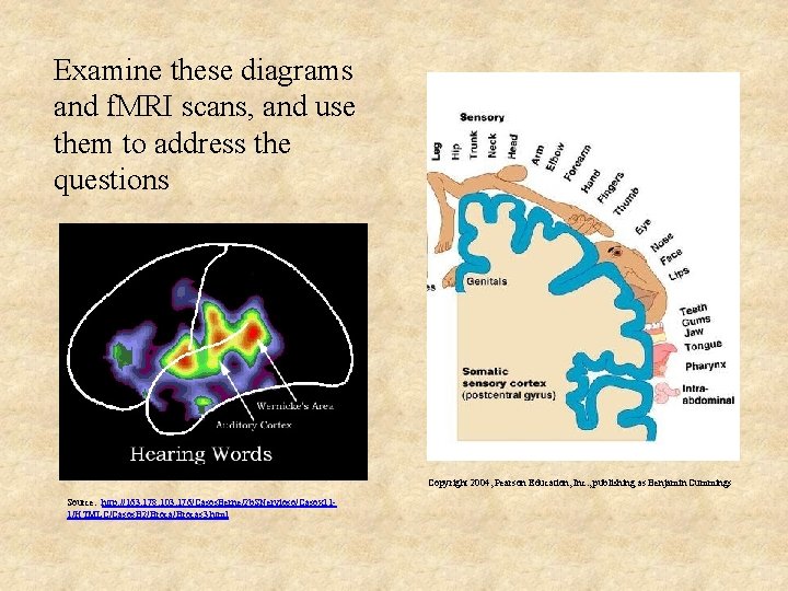 Examine these diagrams and f. MRI scans, and use them to address the questions