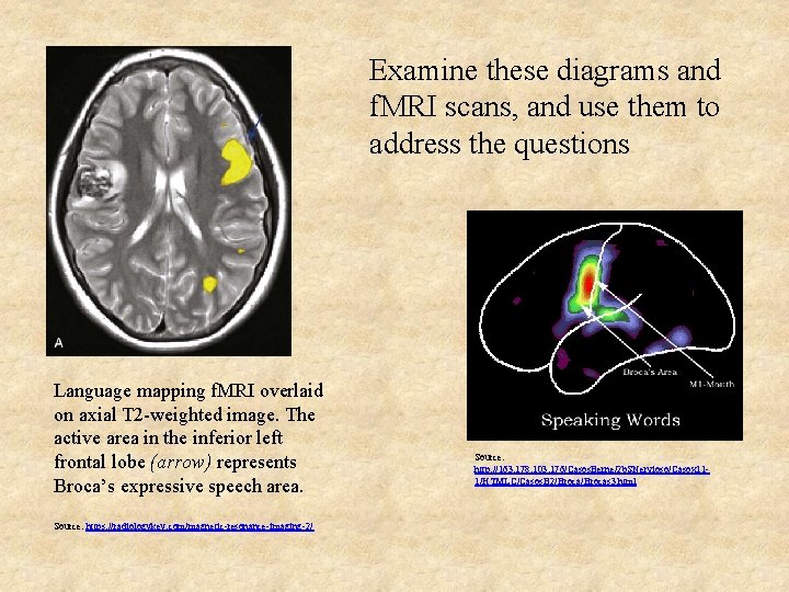 Examine these diagrams and f. MRI scans, and use them to address the questions