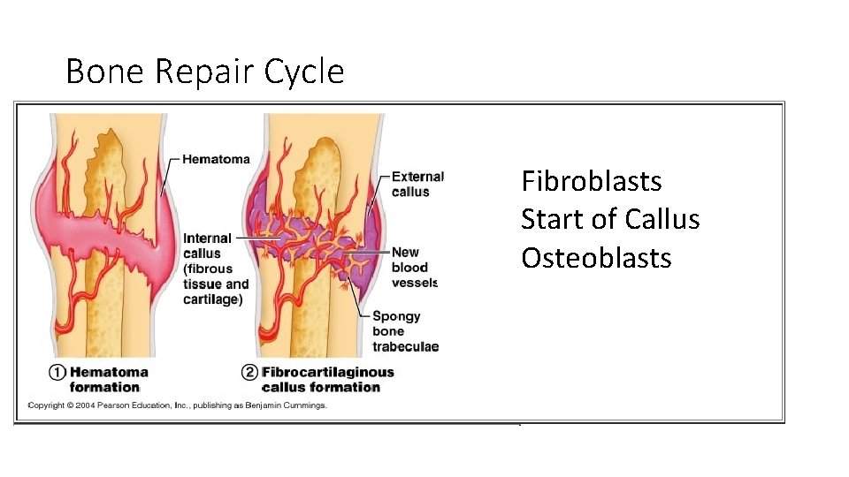 Bone Repair Cycle Fibroblasts Start of Callus Osteoblasts 