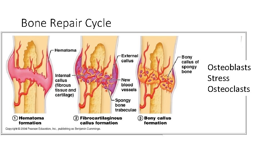 Bone Repair Cycle Osteoblasts Stress Osteoclasts 