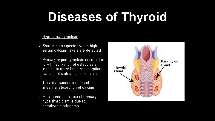 Diseases of Thyroid • Hyperparathyroidism- • Should be suspected when high serum calcium levels