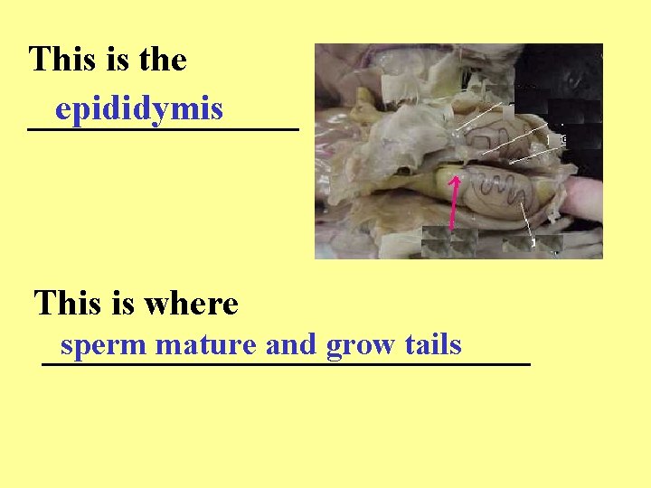 This is the epididymis ________ This is where sperm mature and grow tails ______________