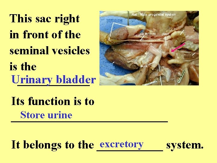 This sac right in front of the seminal vesicles is the ______ Urinary bladder
