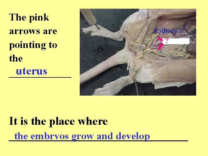The pink arrows are pointing to the uterus ______ ? It is the place