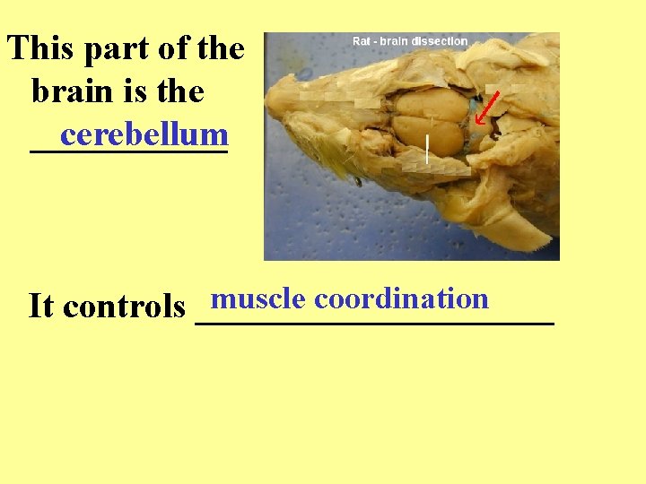 This part of the brain is the ______ cerebellum muscle coordination It controls __________