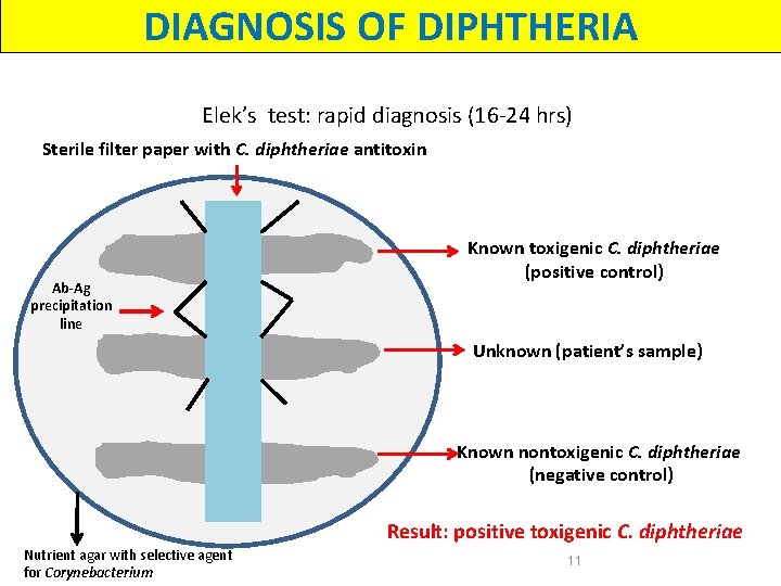 DIAGNOSIS OF DIPHTHERIA Elek’s test: rapid diagnosis (16 -24 hrs) Sterile filter paper with