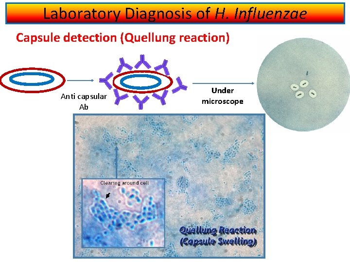 Laboratory Diagnosis of H. Influenzae Capsule detection (Quellung reaction) Anti capsular Ab Under microscope