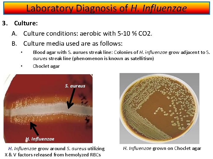 Laboratory Diagnosis of H. Influenzae 3. Culture: A. Culture conditions: aerobic with 5 -10