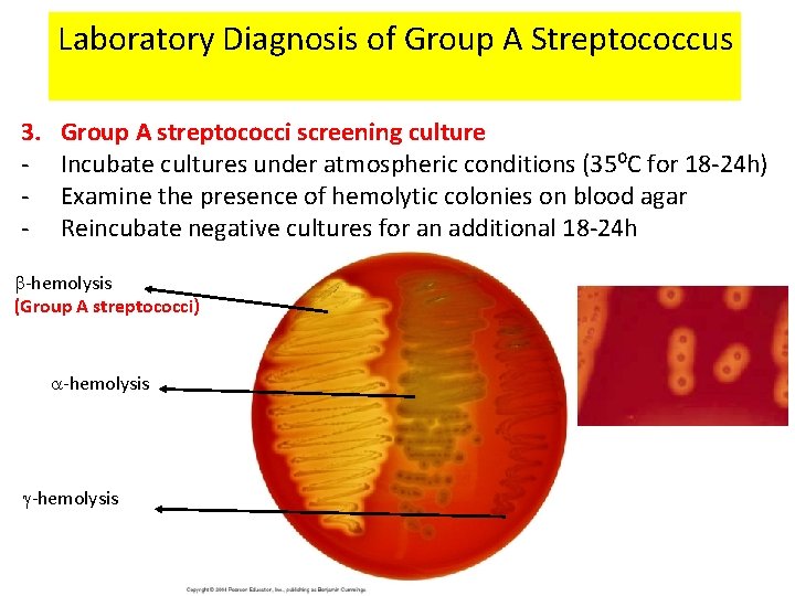 Laboratory Diagnosis of Group A Streptococcus 3. - Group A streptococci screening culture Incubate