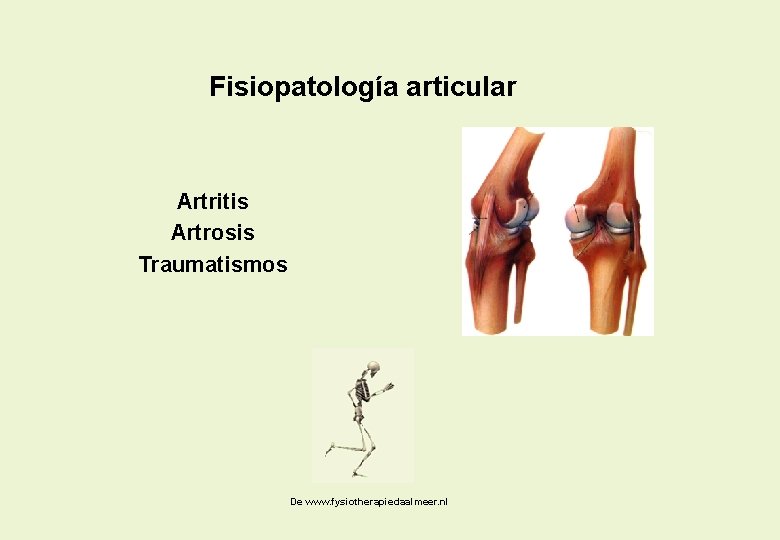 Fisiopatología articular Artritis Artrosis Traumatismos De www. fysiotherapiedaalmeer. nl 