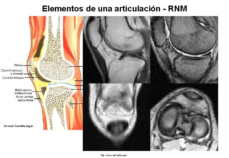Elementos de una articulación - RNM De www. arrakis. es 