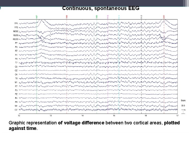 Continuous, spontaneous EEG Graphic representation of voltage difference between two cortical areas, plotted against
