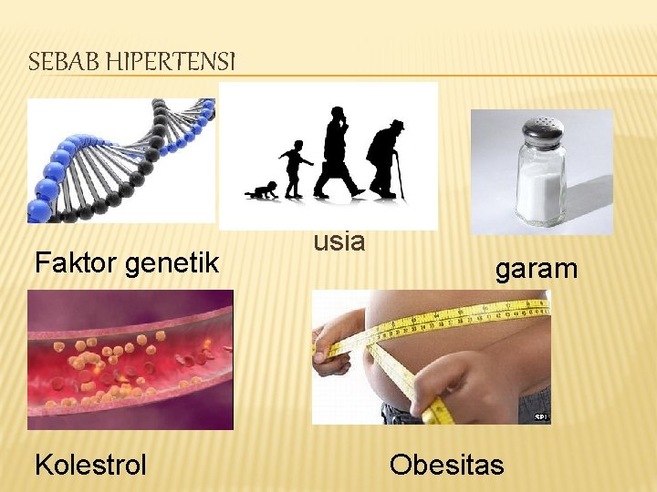 SEBAB HIPERTENSI Faktor genetik Kolestrol usia garam Obesitas 