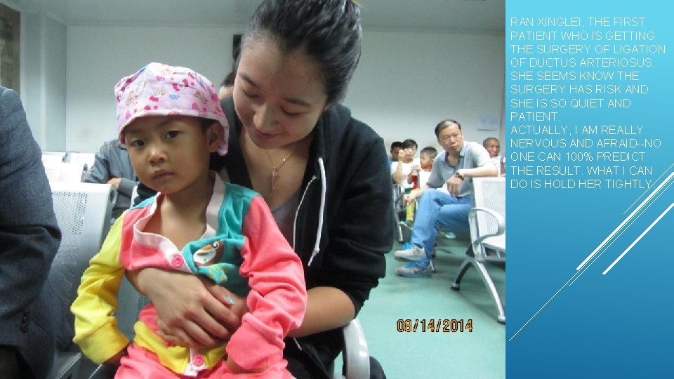 RAN XINGLEI, THE FIRST PATIENT WHO IS GETTING THE SURGERY OF LIGATION OF DUCTUS