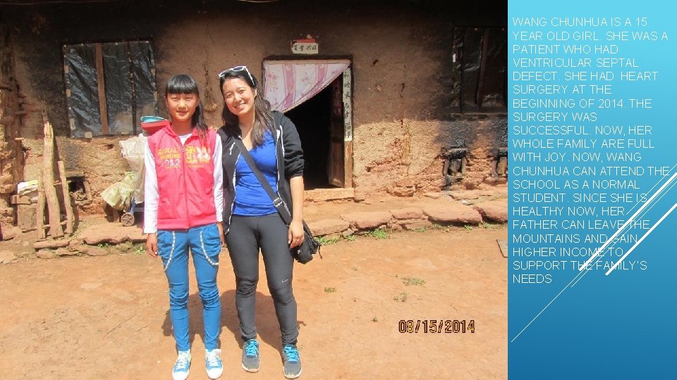 WANG CHUNHUA IS A 15 YEAR OLD GIRL. SHE WAS A PATIENT WHO HAD